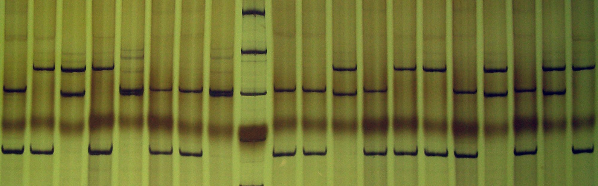 Finding correlation between nutition and genetic studies.